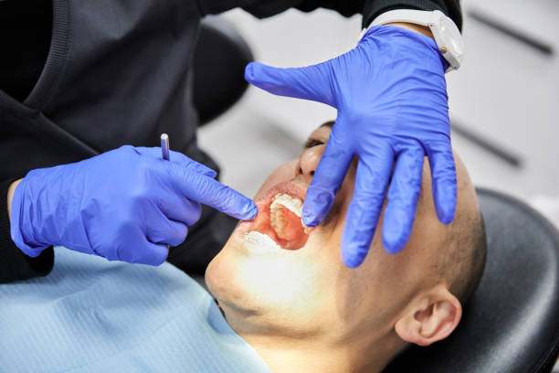 Best Emergency Wisdom Teeth Removal in Lebanon, IL